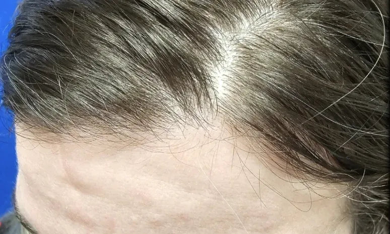 Baseline hair appearance
