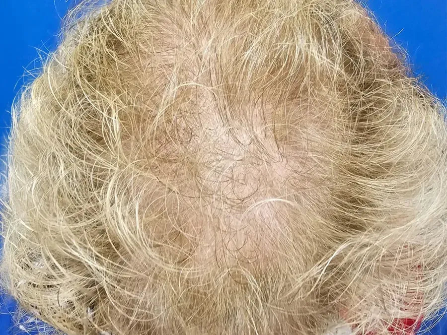 Baseline hair appearance