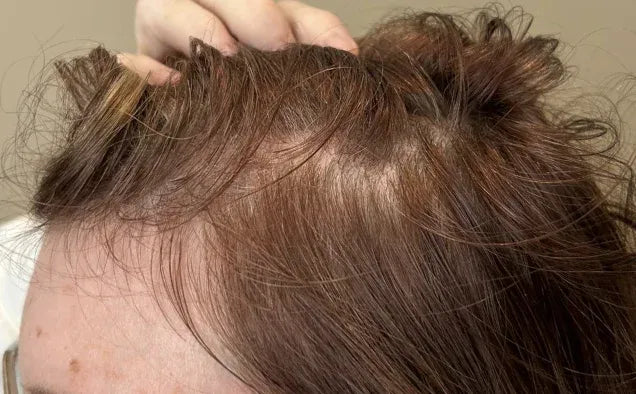 Baseline hair appearance
